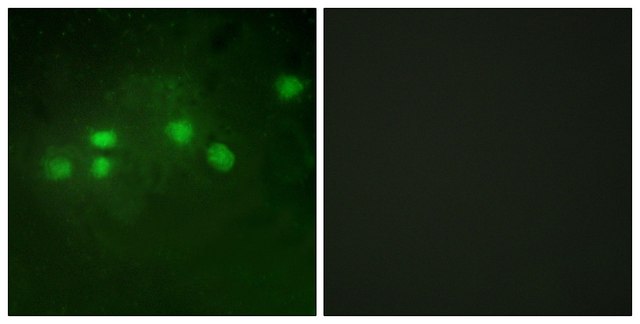 Anti-ELF1 antibody produced in rabbit affinity isolated antibody