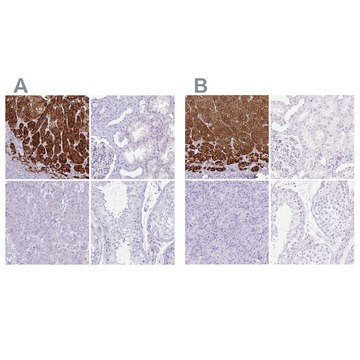 Anti-CYP21A2 antibody produced in rabbit Prestige Antibodies&#174; Powered by Atlas Antibodies, affinity isolated antibody, buffered aqueous glycerol solution