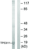 Anti-TP53I11 antibody produced in rabbit affinity isolated antibody