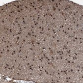 Anti-HSPA6 antibody produced in rabbit Prestige Antibodies® Powered by Atlas Antibodies, affinity isolated antibody, buffered aqueous glycerol solution