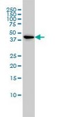 Monoclonal Anti-TSC22D4 antibody produced in mouse clone 3C5, purified immunoglobulin, buffered aqueous solution