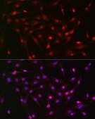 Anti-Pan Lactic acid-Lysine antibody produced in rabbit