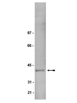 Anti-Gi&#945;1/2 Antibody Upstate&#174;, from rabbit