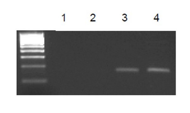 EZ-Magna ChIP&#174; G - 染色质免疫沉淀试剂盒 Single day chromatin immunoprecipitation (ChIP) kit containing all necessary reagents to perform 22 individual chromatin immunoprecipitation (ChIP) reactions using magnetic G beads. Control primers included.