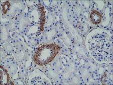 Anti-ACTA2 antibody, Rabbit monoclonal recombinant, expressed in HEK 293 cells, clone RM253, purified immunoglobulin