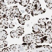 Anti-MTA2 antibody produced in rabbit Prestige Antibodies® Powered by Atlas Antibodies, affinity isolated antibody, buffered aqueous glycerol solution