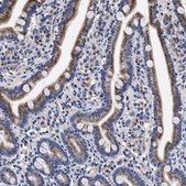 Anti-ACOX1 antibody produced in rabbit Prestige Antibodies® Powered by Atlas Antibodies, affinity isolated antibody, buffered aqueous glycerol solution, Ab2
