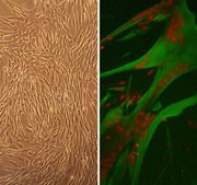 Human Skeletal Muscle Cells: HSkMC, adult