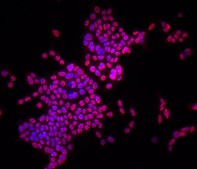Mouse mammary tumor cell line TUBO