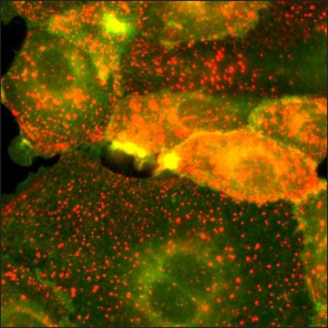 SKOV3 Cells GFP-HER2 RFP-EGFR