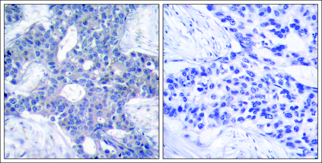 Anti-ZAP70 (Ab-493) antibody produced in rabbit affinity isolated antibody