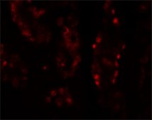 Anti-DISP1 antibody produced in rabbit affinity isolated antibody
