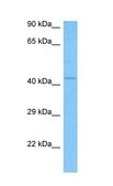 Anti-IL11RA (ab1) antibody produced in rabbit affinity isolated antibody