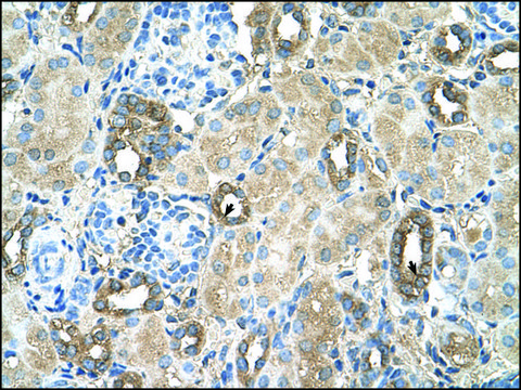 Anti-MGAT2 antibody produced in rabbit IgG fraction of antiserum