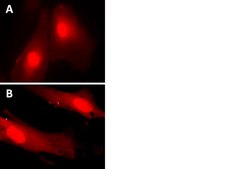 LentiBrite RFP Control Lentiviral Biosensor