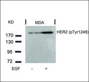 Anti-phospho-ERBB2 (pTyr1248) antibody produced in rabbit affinity isolated antibody