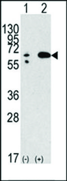 ANTI-BECLIN 1 antibody produced in rabbit IgG fraction of antiserum, buffered aqueous solution