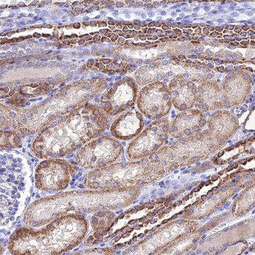 Anti-NDUFV1 antibody produced in rabbit Prestige Antibodies&#174; Powered by Atlas Antibodies, affinity isolated antibody, buffered aqueous glycerol solution