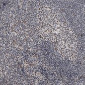 Anti-DDX42 antibody produced in rabbit Prestige Antibodies® Powered by Atlas Antibodies, affinity isolated antibody, buffered aqueous glycerol solution, Ab1