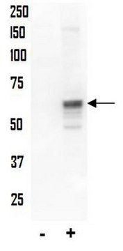 Anti-phospho-AKT (Thr34) Antibody Upstate&#174;, from rabbit