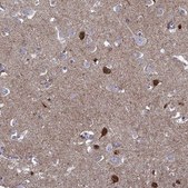 Anti-NPTX1 Prestige Antibodies® Powered by Atlas Antibodies, affinity isolated antibody