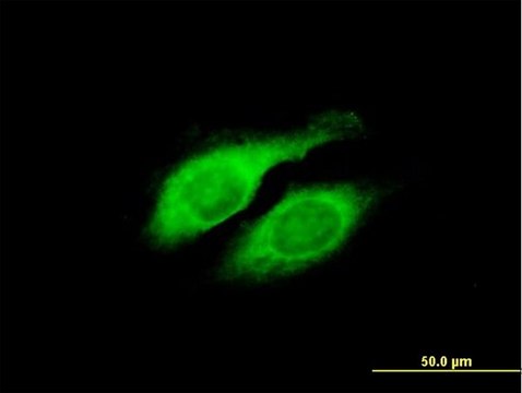 Anti-LYPLA2 antibody produced in mouse purified immunoglobulin, buffered aqueous solution