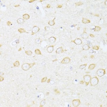 Anti-SQSTM1/p62 antibody produced in rabbit