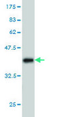 Monoclonal Anti-PPP1R9A antibody produced in mouse clone 6A10, purified immunoglobulin, buffered aqueous solution