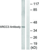 Anti-XRCC3 antibody produced in rabbit affinity isolated antibody