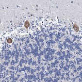 Anti-HSF2 antibody produced in rabbit Prestige Antibodies® Powered by Atlas Antibodies, affinity isolated antibody, buffered aqueous glycerol solution