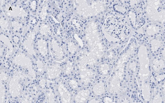 Anti-HMGB1 Antibody, clone 3K6, ZooMAb&#174; Rabbit Monoclonal recombinant, expressed in HEK 293 cells