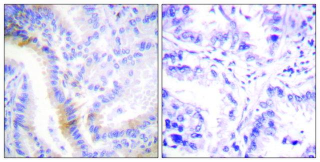 Anti-Urocortin antibody produced in rabbit affinity isolated antibody