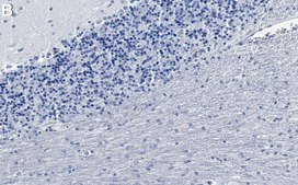 Anti-TSC1 Antibody, clone 1C10 ZooMAb® Rabbit Monoclonal recombinant, expressed in HEK 293 cells