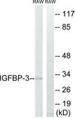 Anti-IGFBP-3 antibody produced in rabbit affinity isolated antibody