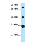 Anti-FIBCD1 antibody produced in rabbit affinity isolated antibody