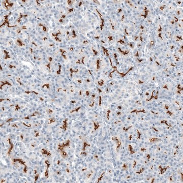 Anti-CFTR antibody produced in rabbit Prestige Antibodies&#174; Powered by Atlas Antibodies, affinity isolated antibody, buffered aqueous glycerol solution