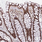 Anti-SRRT antibody produced in rabbit Prestige Antibodies® Powered by Atlas Antibodies, affinity isolated antibody, buffered aqueous glycerol solution