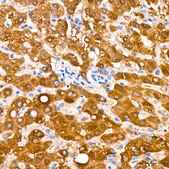 Anti-MGST1 Antibody, clone 6A0S5, Rabbit Monoclonal