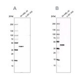 Anti-CAPG antibody produced in rabbit Prestige Antibodies® Powered by Atlas Antibodies, affinity isolated antibody, buffered aqueous glycerol solution, Ab3