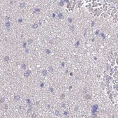 Anti-STIP1 antibody produced in rabbit Prestige Antibodies® Powered by Atlas Antibodies, affinity isolated antibody, buffered aqueous glycerol solution