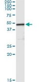 Monoclonal Anti-CPA2 antibody produced in mouse clone 2E11, purified immunoglobulin, buffered aqueous solution