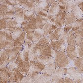 Anti-ADIPOR2 antibody produced in rabbit Prestige Antibodies® Powered by Atlas Antibodies, affinity isolated antibody, buffered aqueous glycerol solution