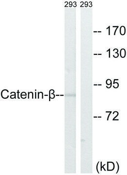 Anti-Catenin-&#946; antibody produced in rabbit affinity isolated antibody