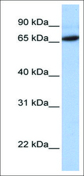 Anti-FOXO1 (AB2) antibody produced in rabbit affinity isolated antibody