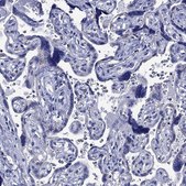 Anti-ACADSB antibody produced in rabbit Prestige Antibodies® Powered by Atlas Antibodies, affinity isolated antibody, buffered aqueous glycerol solution