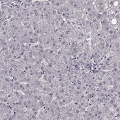 Anti-RIT2 antibody produced in rabbit Prestige Antibodies® Powered by Atlas Antibodies, affinity isolated antibody