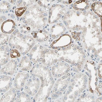 Anti-PTH1R antibody produced in rabbit Prestige Antibodies&#174; Powered by Atlas Antibodies, affinity isolated antibody, buffered aqueous glycerol solution