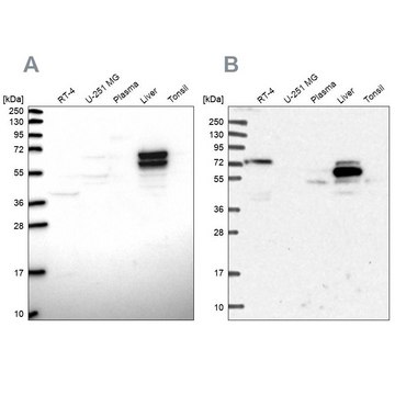 Anti-ACSS3 antibody produced in rabbit Prestige Antibodies&#174; Powered by Atlas Antibodies, affinity isolated antibody, buffered aqueous glycerol solution