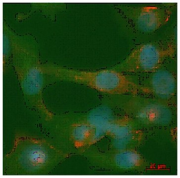 抗磷酸化ILK (Ser246) 抗体 from rabbit, purified by affinity chromatography