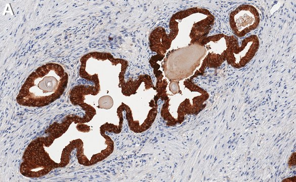 Anti-UGDH Antibody, clone 1F18 ZooMAb&#174; Rabbit Monoclonal recombinant, expressed in HEK 293 cells